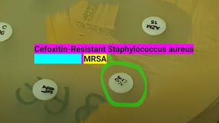 Profiling and Clinical Implications of CefoxitinResistant Staphylococcus aureus A Focus on MRSA [upl. by Narik968]