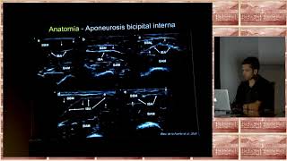 2018 diagnóstico ecográfico en las lesiones del tendón distal del bíceps [upl. by Cir]