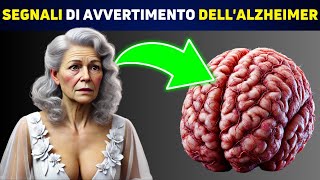 SCIENTIFICO Queste 5 Abitudini Sono Legate allAlzheimer [upl. by Packston]