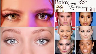 Botox Brow Lift  How Botox can help with Hooded Eyes and other Eye Shapes [upl. by Worthy690]