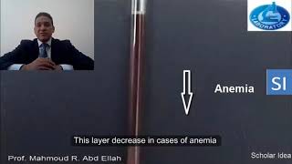 Significance of Hematocrit Packed cell volume [upl. by Atnim]