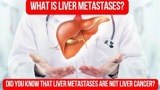 Deciphering LIVER METASTASES Exploring Secondary Liver Cancer [upl. by Anoli112]