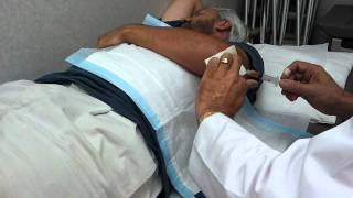 Left elbow olecranon bursitis drain [upl. by Eenaj]