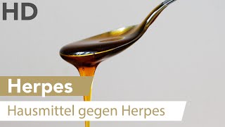 Herpes an der Lippe Dieses natürliche Hausmittel kann helfen [upl. by Zsuedat]