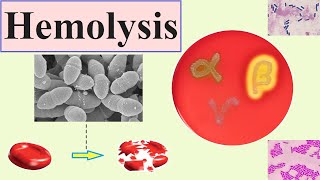 hemolysis [upl. by Onaicul]