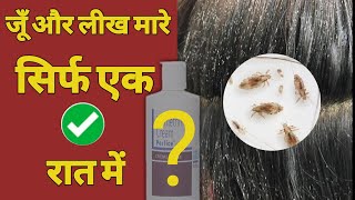 एक बार लगाओ लीख हटाओ  जू और लीख हटाने का अचूक फॉर्मूला how to use perlice cream on hair [upl. by Omidyar151]