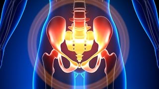 Wise Anderson Protocol  A Headache in the Pelvis [upl. by Edla566]