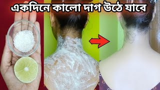 ১ দিনে  গলা ও ঘাড়ের জেদী কালো দাগ দূর হবেgola o gharer kalo dag dur korar upay Neck Whitening [upl. by Nwhas]