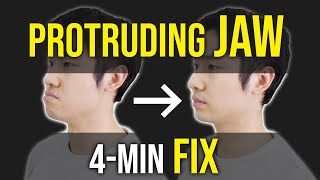 Protruding Jaw  Underbite Fix ｜Facial Asymmetry Correction｜Corrective Exercises [upl. by Leavy]