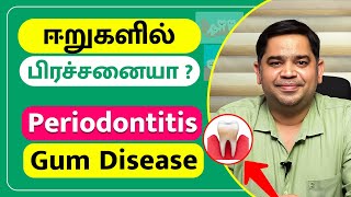 ஈறுகளில் பிரச்சனையா  Periodontitis Gum Disease  Dr Abisheik Johnson Babu  Trinity Dental Clinic [upl. by Eyram658]