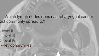 RETROPHARYNGEAL NODESNODES OF ROUVIERE [upl. by Eltsirc]