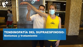 Tendininitis del supraespinoso qué es y qué hacer  CuídatePlus [upl. by Oznohpla]