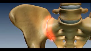 Where is the Sacroiliac Joint Anatomy of the Sacroiliac Joint [upl. by Pimbley]