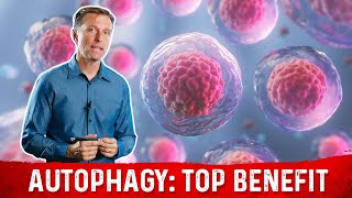 The Most Important Benefit of Autophagy Will Surprise You [upl. by Salsbury]