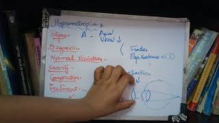 HYPERMETROPIA important topic full explanation part 2 [upl. by Joellyn960]