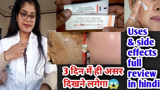 Demelan Cream  Demelan Cream honest review  Demelan Cream benefits uses amp side effects in hindi [upl. by Eelano]