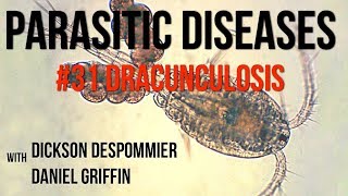 Parasitic Diseases Lectures 31 Dracunculosis [upl. by Eissat673]