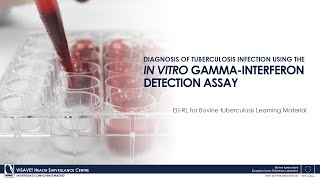 Diagnosis of Tuberculosis Infection using the In Vitro GammaInterferon detection Assay [upl. by Elram981]