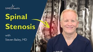 Spinal Stenosis Causes Symptoms Treatment [upl. by Yblehs]