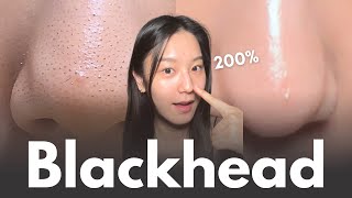 How to really remove blackheads at home in 7 days No matter your skin type [upl. by Trager]