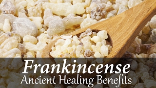 The Benefits and Uses of Frankincense Essential Oil [upl. by Noira]