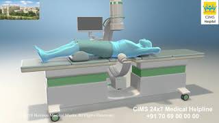 Extracorporeal Shock Wave Lithotripsy ESWL – CIMS Hospital [upl. by Hsivat]