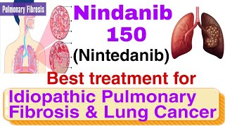 Nindanib 150 Nintedanib 150 mg complete reviewUsage dosage precautionsside effectsHindi [upl. by Inhsor]