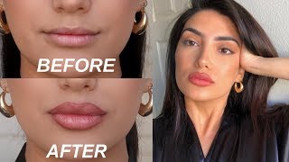 HOW TO FAKE BIG LIPS IN 3 EASY STEPS OMG [upl. by Oirasec652]