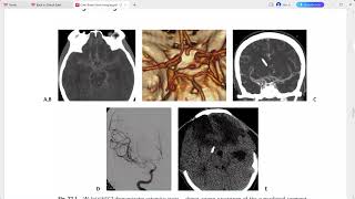 CASE BASED BRAIN IMAGING [upl. by Maroney]