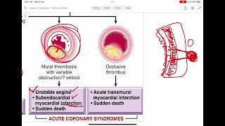 1 Ischemic Heart Disease [upl. by Stranger]