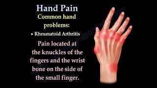 Hand and Finger Pain Common Causes and Symptoms Explained [upl. by Land]