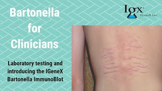 Introducing IGeneX Bartonella ImmunoBlots [upl. by Nahshon]