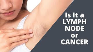 Could The Lump In My Armpit Be A Lymph Node Or Cancer Lymphoma [upl. by Nedrud871]