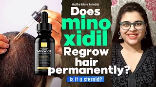 Does Minoxidil Regrow hair permanently Minoxidil side effects Minoxidil results Hair fall [upl. by Higgs]