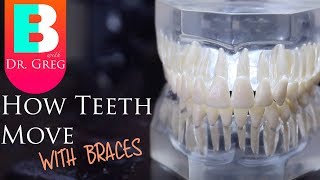 BRACES EXPLAINED How Teeth Move  Braces Work [upl. by Ragan]