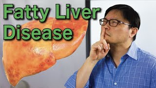 How to Reverse Fatty Liver Disease Naturally  Jason Fung [upl. by Jehias293]