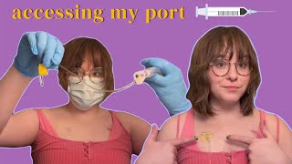 ACCESSING MY PORT Chronic illness [upl. by Harahs570]