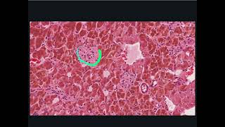 Endocrine System Histology  Adrenal Medulla [upl. by Oijres61]