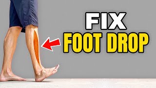 3 Exercises to Correct Foot Drop [upl. by Clawson630]