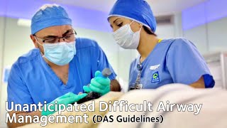 Unanticipated Difficult Airway Management [upl. by Enos859]