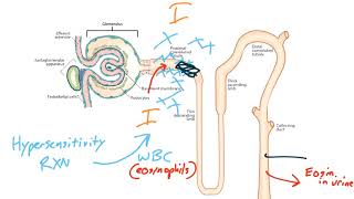 Acute Kidney Injury for the USMLE Step 1 [upl. by Yenttihw]