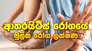 ආතරයිටීස් රෝගයේ මුලික රෝග ලක්ෂණ ayurveda arthritis arthritiscure arthritistreatment [upl. by Godspeed]