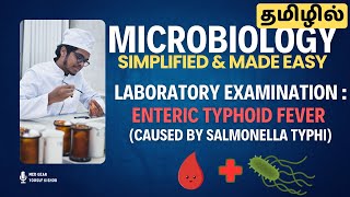 Hemoculture🩸 examination 🧪in Enteric Typhoid Fever 🤒 EASY EXPLANATION தமிழில்  Microbiology 🧫 [upl. by Zeuqirdor]