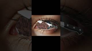 maggots asmr  dog asmr  asmr tick removal aniamtion  satisfying video tick removal dogticks [upl. by Hankins]