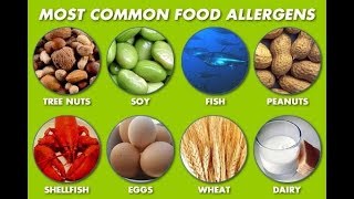 Types of Food allergies Causes Signs and Symptoms of Food allergy [upl. by Marcus]