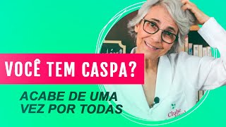 Como acabar com a caspa e seborréia naturalmente de uma vez por todas [upl. by Llenehc]