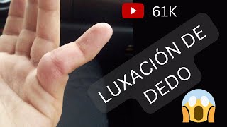 Reducción de Luxación de dedo shorts juancalbornoz luxación [upl. by Belldame369]