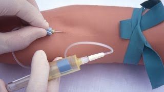 Performing a venipuncture using a butterfly needle [upl. by Milburn]