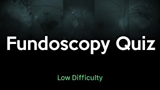 Fundoscopy Quiz Low Difficulty [upl. by Akimyt453]