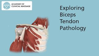 Exploring Biceps Tendon Pathology [upl. by Anikas]